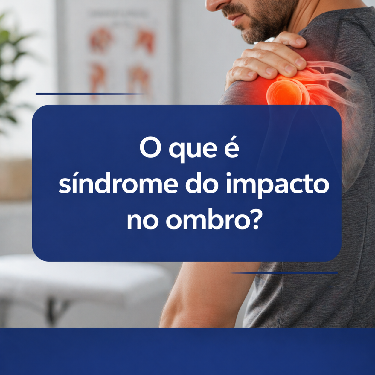 O que é síndrome do impacto no ombro?